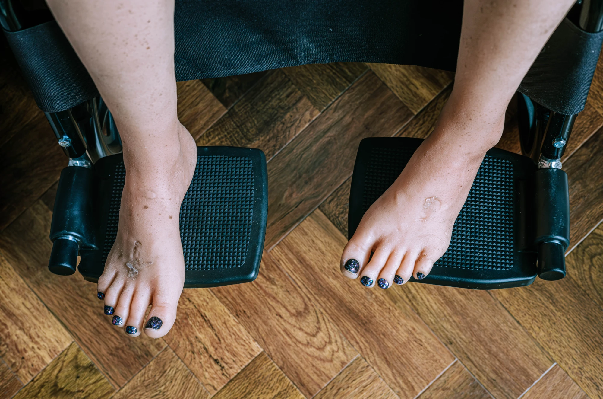A close up of the doll's feet. They are hyper-realistic but damaged.